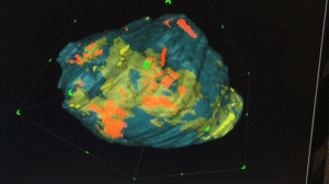 3D reconstructed single particle of Si-C composite using SEM images obtained from the FIB milling process